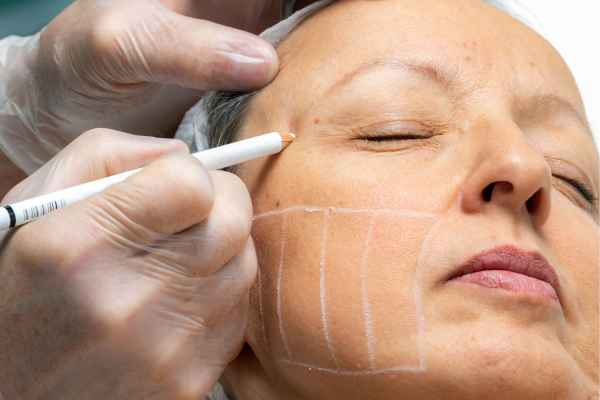 What should you ask before having CryoPen treatment Ayr?