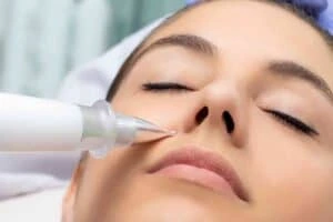Actinic keratoses Ayr solutions - book in today!