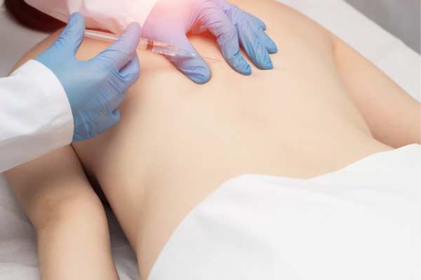 Lipo Sculpt will offer the best fat back reduction Ayr call us today!