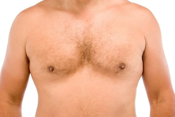 Fat freezing for moobs reduction treatment Ayr book in today!