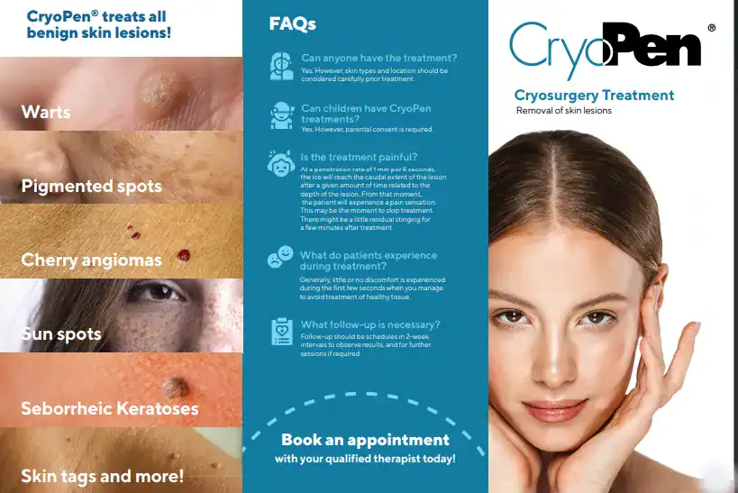Benefits of Cryopen for seborrheic keratosis Removal Treatment Ayr