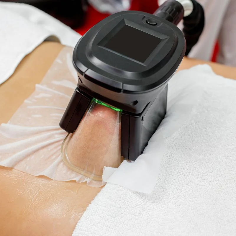 Fat Freezing treatment Ayr