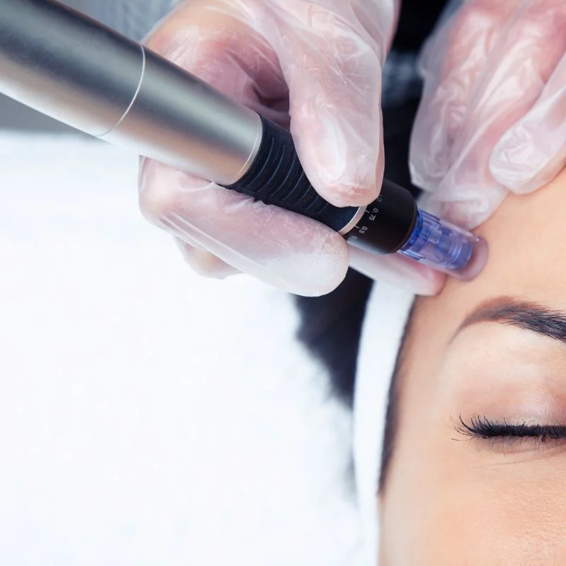 tightening treatment Ayr
