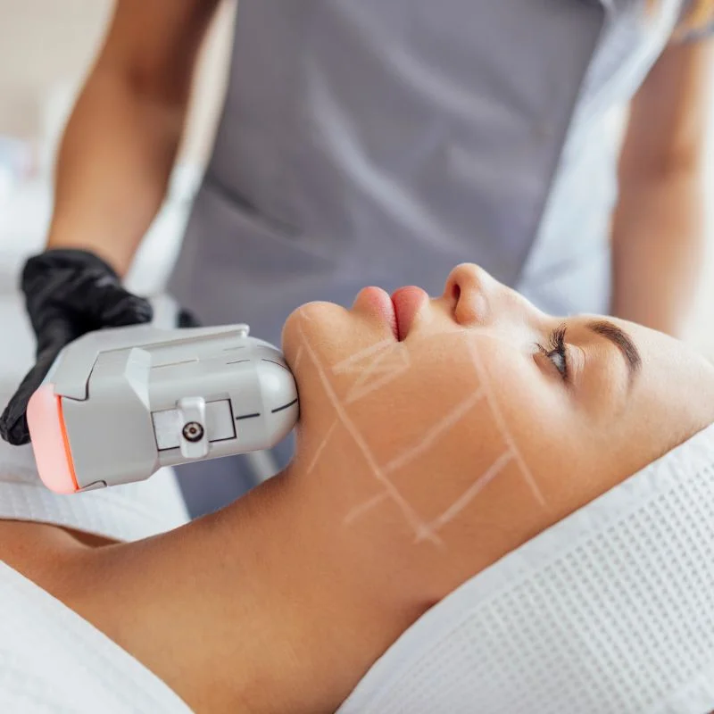 HIFU non surgical treatment Ayr