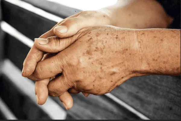 Protecting your skin after treatment